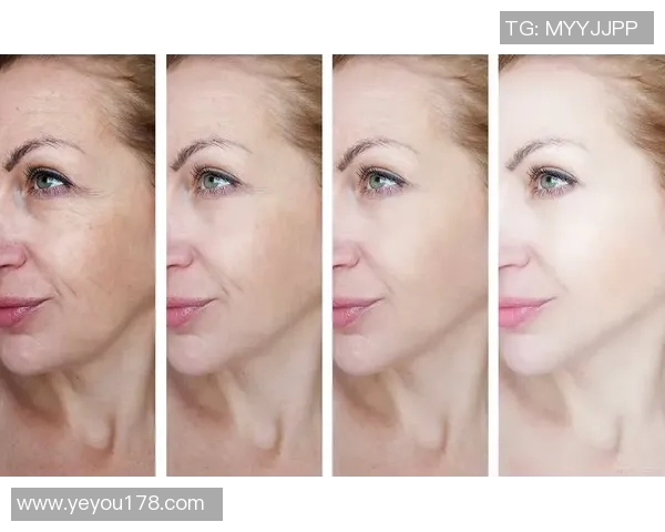 足球明星分享祛除抬头纹的秘密技巧与护肤心得让你重拾年轻光彩